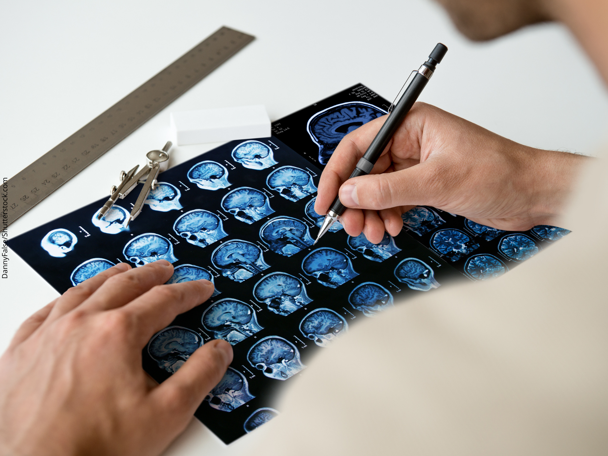Brain-machine interface technology brings new perspectives for people with severe paralysis